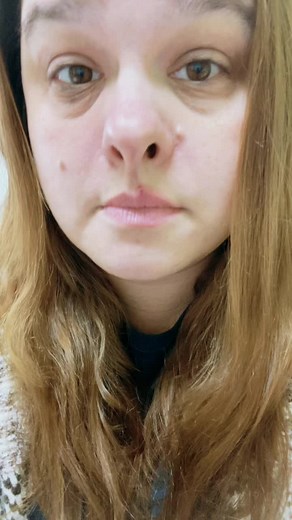 Endometrial Biopsy Experience: A Painful Journey