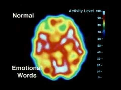 psychopath mri - general psychology