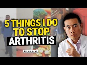 5 Things I Do to STOP my Arthritis Flares: Rheumatologist Explains