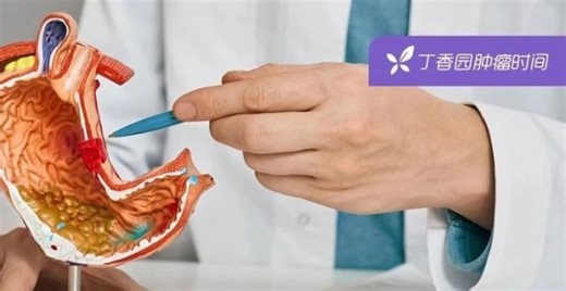 不是 CapOx!原来更适合亚洲胃癌患者的围手术期化疗方案是「它」_腾讯新闻