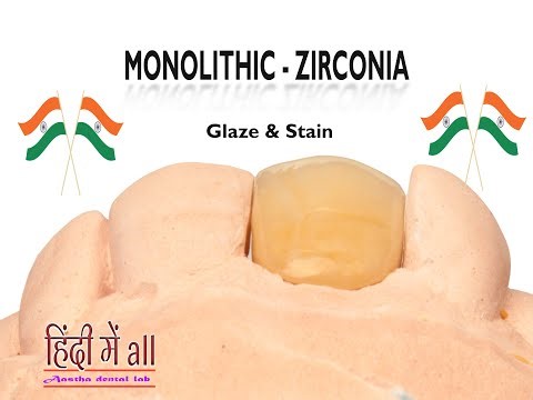 Stain & Glaz || Monolithic Zirconia Crown & Bridge || Anterior Solid Zirconia Staining and Glazing