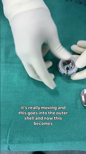 Bipolar (Partial) Hip IMPLANT explained