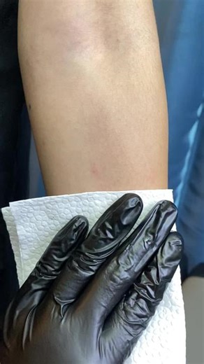 Creating Art on Skin: Line Drawing Techniques