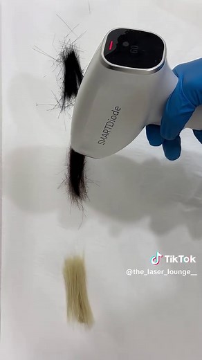 FLASH WARNING⚠️ Laser hair removal works by targeting melanin (pigment) within the hair follicle. In this test, you can clearly see how darker strands absorb more energy, while lighter hair responds differently due to lower pigment levels. Understanding your hair and skin type is essential for safe, effective results. Book a consultation to find out what’s best suited to you. #laserhairremoval #hair #hairfree #smartdiode #fyp
