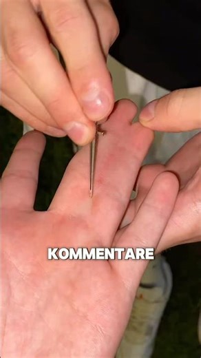 The real reason his fingers are stuck together 💀😭 #shorts