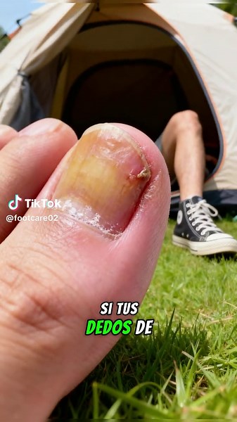 Simplest Nail Health Solutions for Common Issues