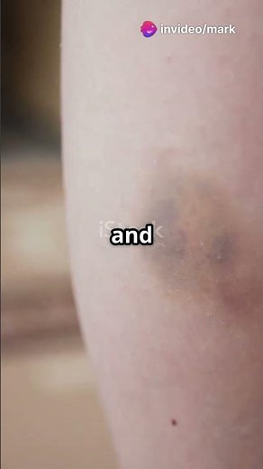 Best Antibiotic Treatments for Skin Infections | Creams vs. Oral Medications Explained