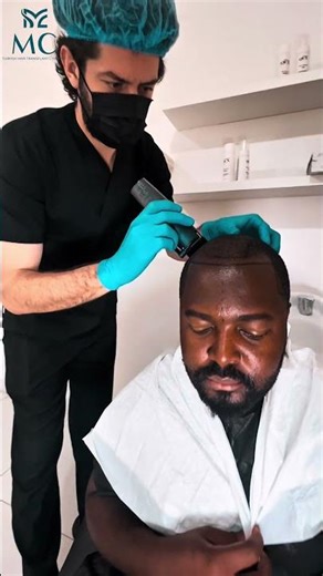 MC Turkish Hair Transplant _ Expert Consultation