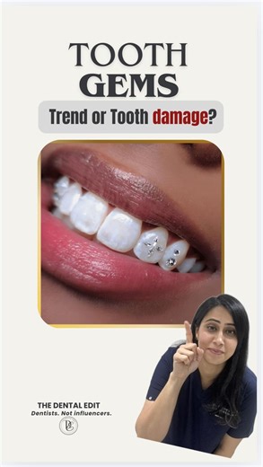 The Dental Edit on Instagram: "Would you get these tooth diamonds put on your teeth?"