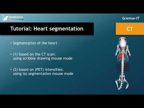Tutorial video (CT): "Heart segmentation"