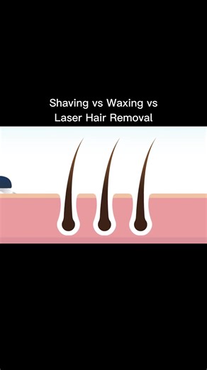 Hair Removal: Waxing vs Shaving vs Laser - A Comprehensive Comparison