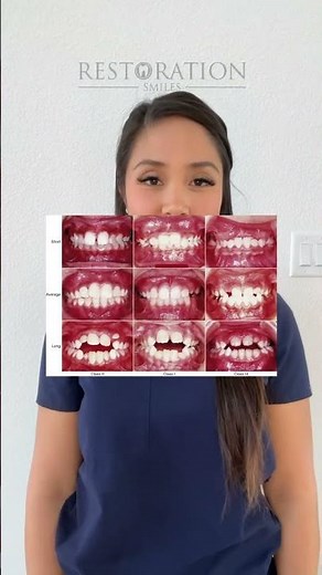 What is Malocclusion?