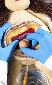 989K views · 1.9K reactions | Kids Ask, We Explain: How Babies Are Born | Crafty Gadgets | Facebook