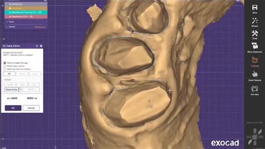 Lana CAD CAM on Instagram: "To be better ✨💪🏻 #explore #exocad #exocadexperts #dentaltichnician #dentaltechnicianstudent"