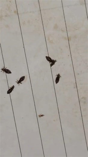 How to Identify Lice spread?#shorts #youtubeshorts #yt #viral #trending #new #fypシ゚viral #trending