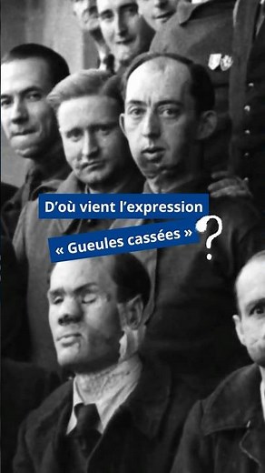 D’où vient l’expression « Gueules cassées » ?