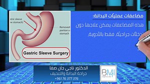 27 reactions | Interview with #Dr_Nagi_Jean_Safa about #weight_loss_surgery #complications, #obesity_surgery, and #gastric_sleeve. مقابلة مع #الدكتور_ناجي_جان_صفا حول #مضاعفات #جراحة_إنقاص_الوزن إنقاص_الوزن #النظام الغذاي #جراحة_البدانة# #قص_المعدة #weightloss, #diet #_ناجي_صف | Dr Nagi Jean Safa - Advanced BMI Lebanon - مركز الدكتور ناجي جان صفا | Facebook