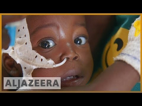 🇨🇫Central African Republic's 45,000 children at risk of starvation - UNICEF l Al Jazeera English