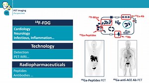 Patient pathway - Diagnostic tests using positron emission tomography : example of 18F-FDG PET