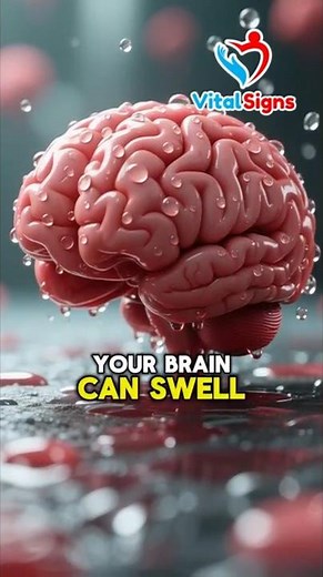 Hyponatremia Warning: Subtle Signs You’re Drinking Too Much Water