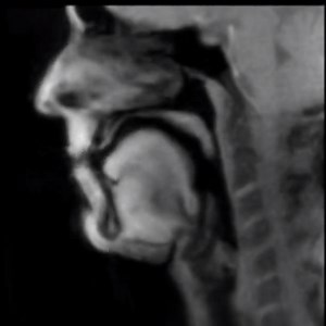 Beatboxer Timo Schnepf was able to perform inside a real-time #MRI. This invention allows for the first time real videos from the inside of the human body. A microphone that uses light instead of electricity captures the audio. #radtech #technologist #radtechlife #imaging | American Society of Radiologic Technologists
