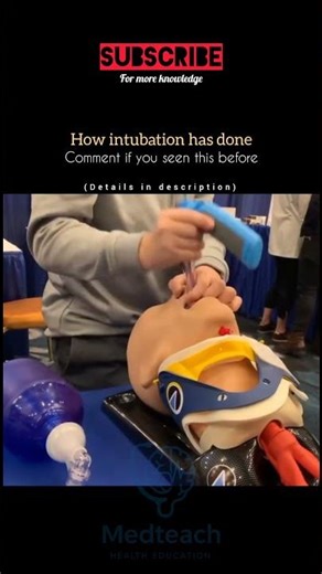 “Life-Saving Skill: How Intubation Keeps You Breathing” 🫁💉 #youtubeshorts #healthshorts