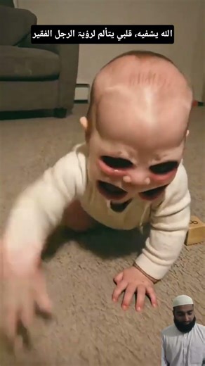 هٰذَا الشَّخْصُ مُعَاقٌ، اللّٰهُمَّ اشْفِهِ 🤲