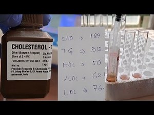 Lipid profile procedure, CHOLESTEROL,TRIGLYCERIDES ,HDL, VLDL ,LDL #medicallaboratoryscience #medlab