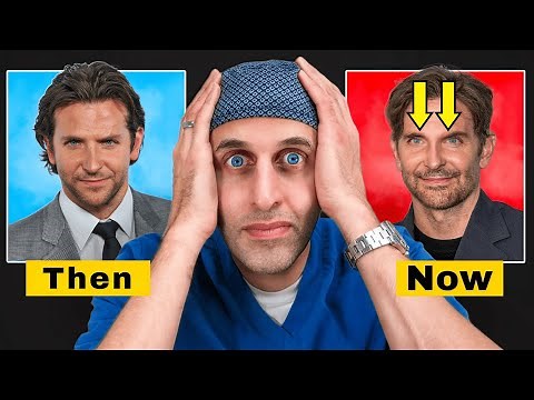 Did Bradley Cooper Get BOTCHED Eyelid Surgery? Doctor Reacts