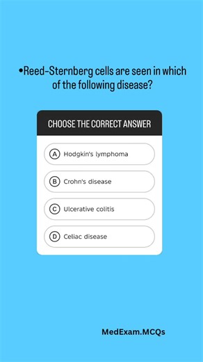 Medical Exam MCQs on Instagram: "Explanation:⤵️ *Correct Answer is A 🔷Reed–Sternberg cells are large, abnormal B lymphocytes that are the hallmark of Hodgkin lymphoma. •They have a bilobed nucleus with prominent nucleoli, giving an “owl’s eye” appearance under the microscope. •These cells typically express CD15 and CD30 surface markers but are negative for CD45. •Their cytokine secretion attracts inflammatory cells, creating the mixed cellular background characteristic of Hodgkin lymphoma. **Ul