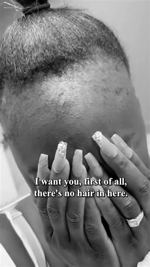 My stylist nearly dropped her brush when she saw how much hair I'd regrown in just 4 months. She leaned in, parted a section of my hair again, then looked at me, eyes wide. “Wait… what are you using? Your hair is growing in thick again! Look at your edges!” I’ll never forget that moment. Just three months earlier, I’d sat in that same salon chair, fighting back tears under the dryer hood. My stylist—gentle, kind, and real—had hesitated before asking if I’d thought about taking a break from braid