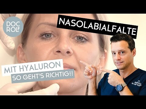 NASOLABIALFALTEN MIT HYALURON ERKLÄRT von Dr. Rolf Bartsch