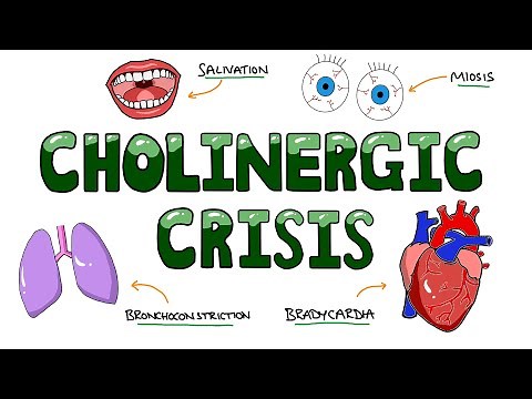 Signs and Symptoms of Cholinergic Crisis - DUMBBELLS Mnemonic