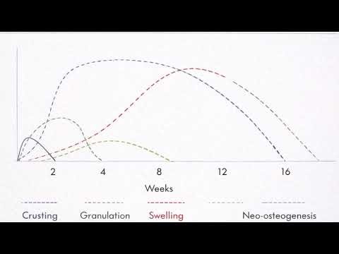 POST FESS HEALING PROCESS