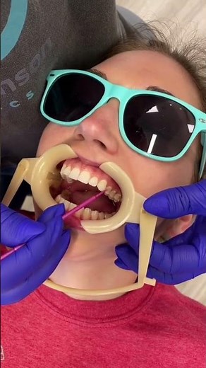 How LightForce #braces are put on. #LightForce #BracesColors #bracestreatment