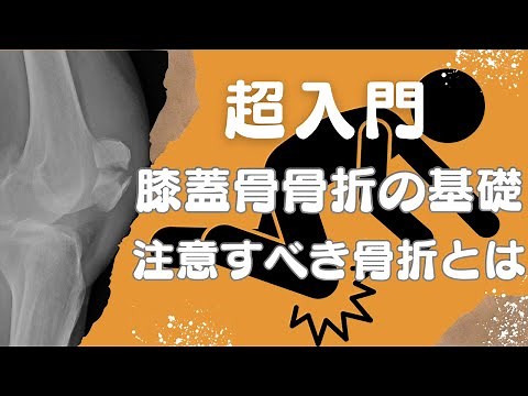 [Super Beginner] The basics of patellar fractures and types of fractures to be aware of