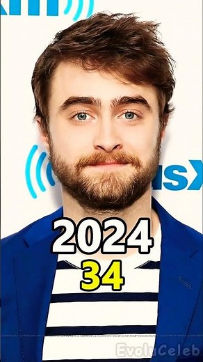 Daniel Radcliffe Through the Years (2000–2025) 🧙 | Amazing Glow-Up #Shorts