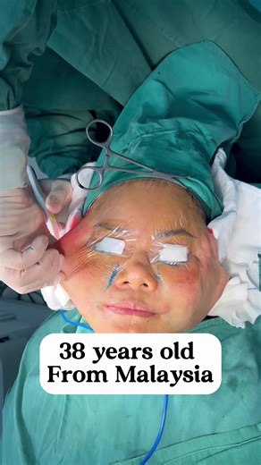 The Benefits of Facelift Procedures for Youthful Skin