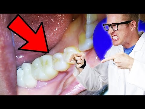 Dentist Explains Every Cause of TOOTH THROBS & PULSATING GUMS! Even Pain that Comes and Goes.