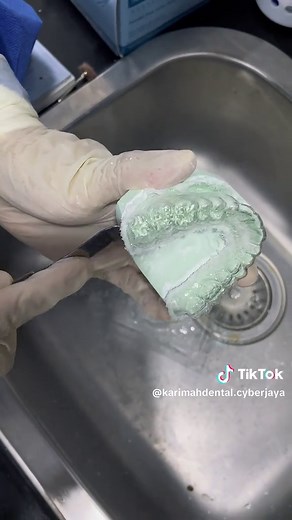 How Retainers Are Made: A Step-by-Step Guide