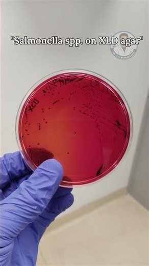 🦠 Can you identify this foodborne pathogen before the reveal? 🔬🧫#biology #science #bacterialworld
