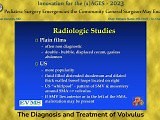 The Diagnosis and Treatment of Volvulus • Video • MEDtube.net