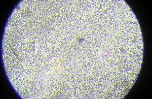 Sperm cells under the microscope