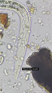 Soil Microbe Library on Instagram: "@420nomad707 shared this video of a bacterial feeding nematode. We are both curious about how this mouth part functions. I assume it’s eating, I have seen the opening and closing of the median and terminal bulbs, but the movement by the mouth is new to me."