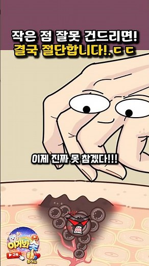 작은 점 잘못 건드리면! 결국 절단합니다!ㄷㄷ