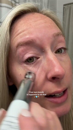 Red light therapy and microcurrent in one under-eye cream, and yes your eye actually twitches a