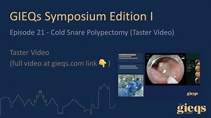 Episode 21 - Cold Snare Polypectomy (Taster Video)