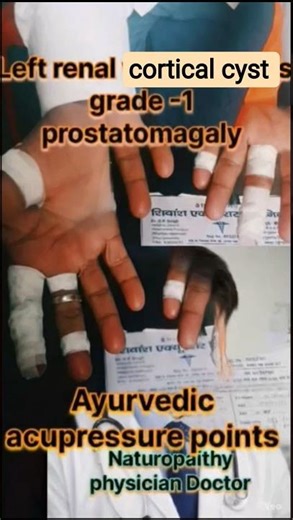Left renal cortical cyst and prostatomegaly #therapistworldclubdoctor #foryou #therapy #renalcysts