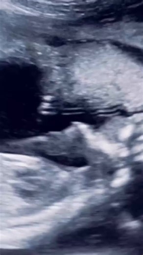 Safety-Verse on TikTok