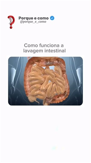 Vem aqui | ⁉️A lavagem intestinal, também conhecida como enema ou clister, é um procedimento usado para limpar o intestino grosso (cólon) através da... | Instagram
